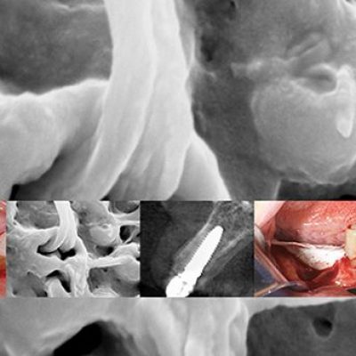 perfeccionamiento-implantologia-avanzada-home